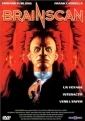 brainscan_photo.jpg