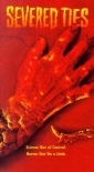 severed_ties_pic.jpg