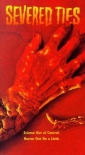 severed_ties_picture.jpg